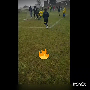 7 year old both feet on fire